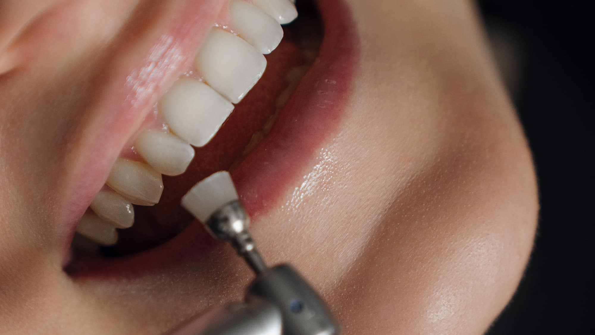 Заморозили цены на терапию в январе